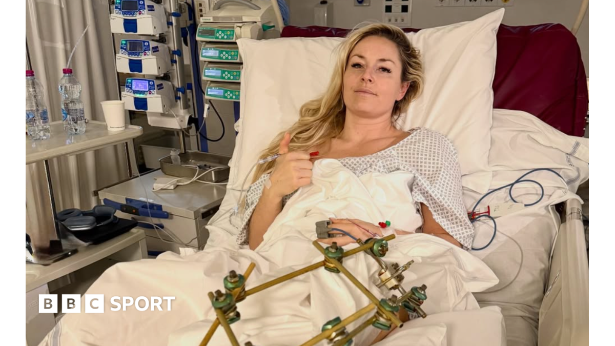 Vonn 'making progress' after third leg operation