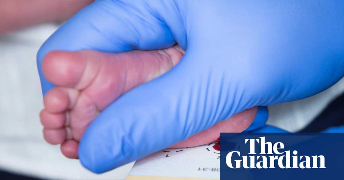 All newborns in England to be screened for spinal muscular atrophy from 2027