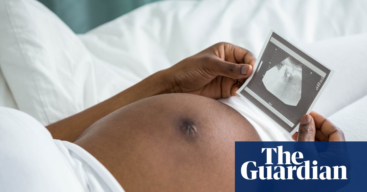 Stress from racism may help explain why black women more likely to die in childbirth, study finds