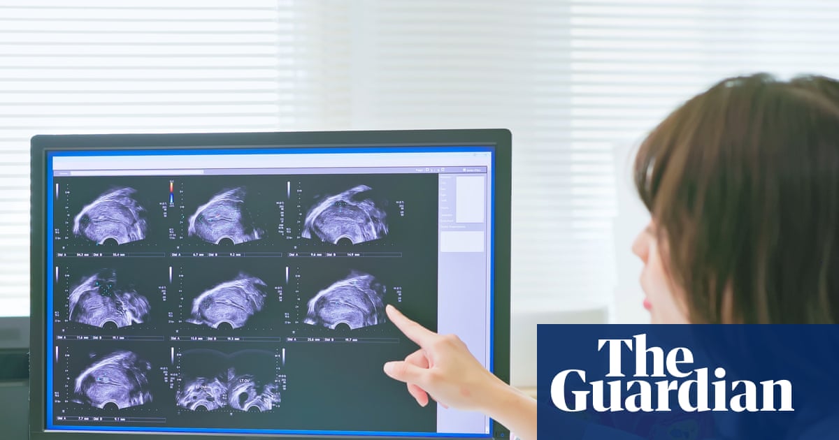 Trial of non-invasive endometriosis scan boosts hopes for quicker diagnosis