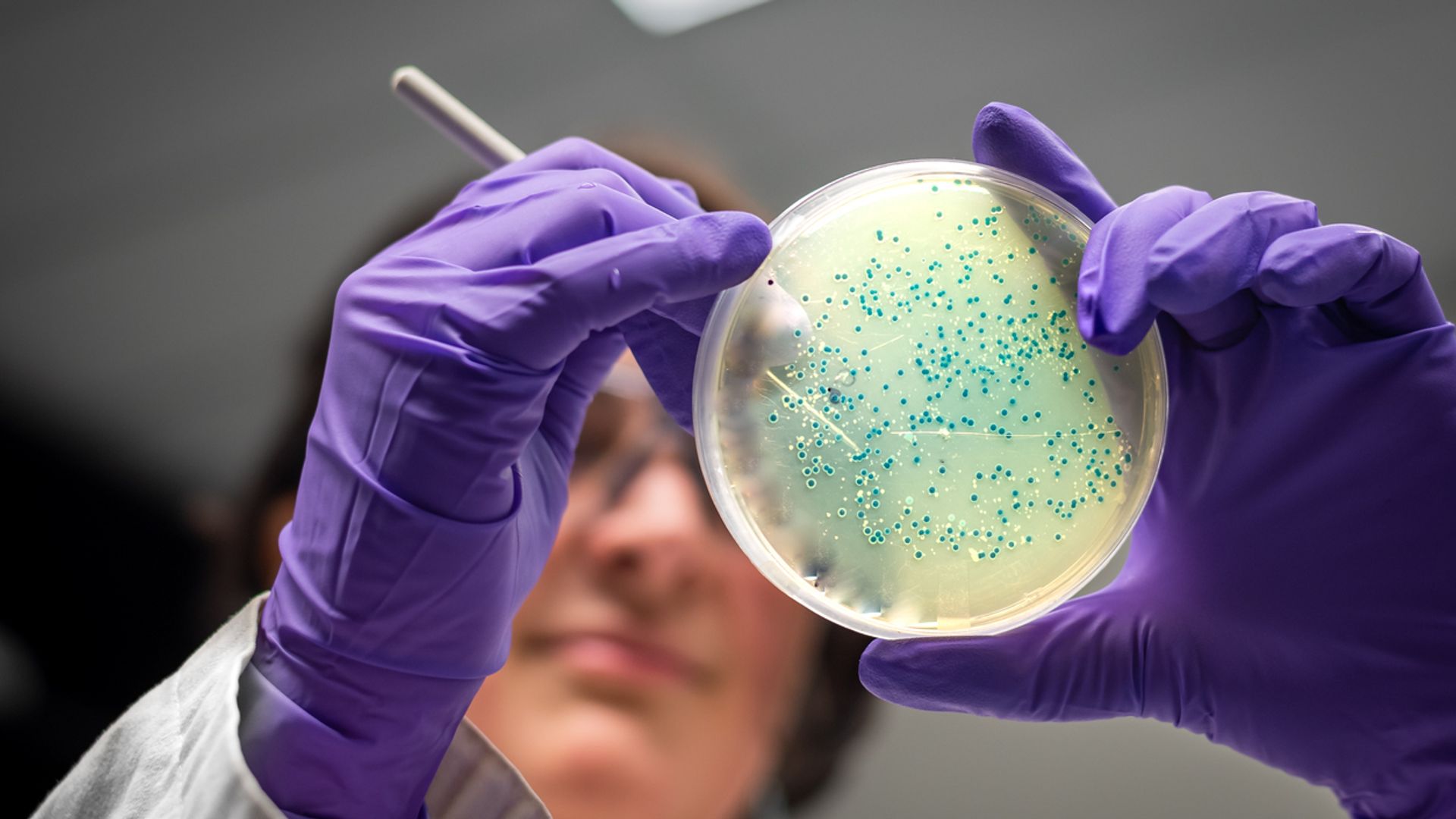 Deadly salmonella outbreak leaves hundreds ill - as warning issued