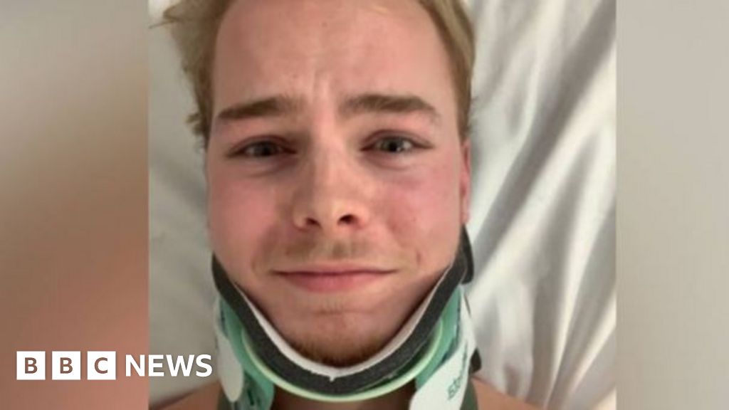 I was in a car crash - then I forgot how to speak Welsh