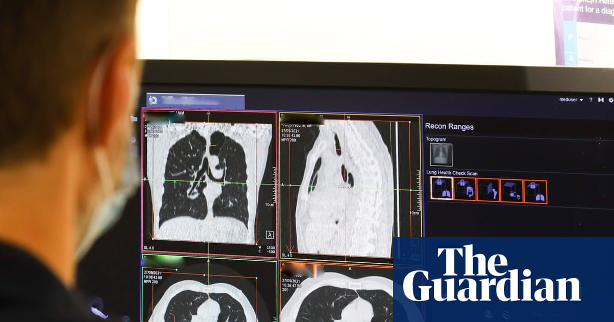 NHS spends record £241m outsourcing scan analysis to private firms
