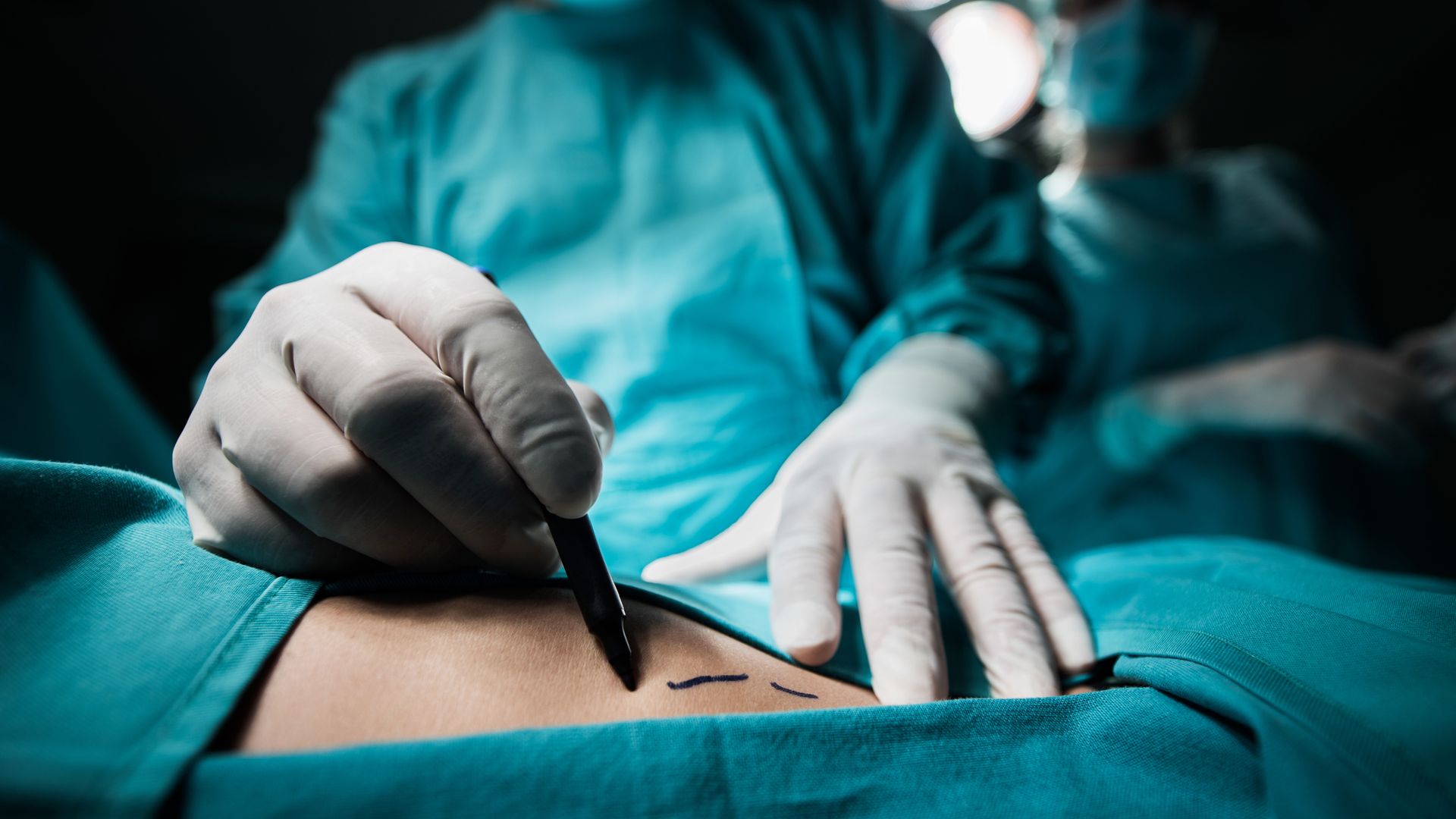 Brazilian butt lifts 'should be banned immediately' following deaths