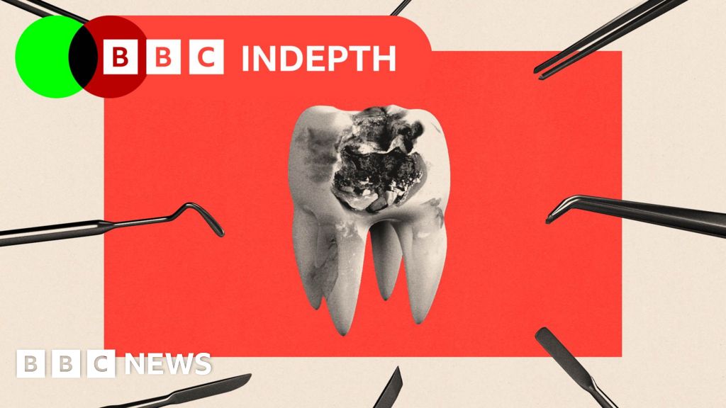 NHS dentistry is rotting. Will the plan to fix it work?