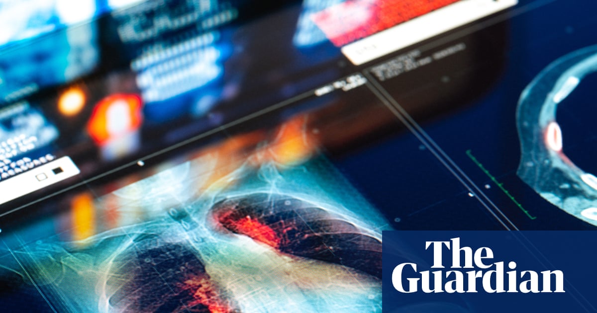 Doctors and NHS could be sued for mistakes made by AI tools, report warns