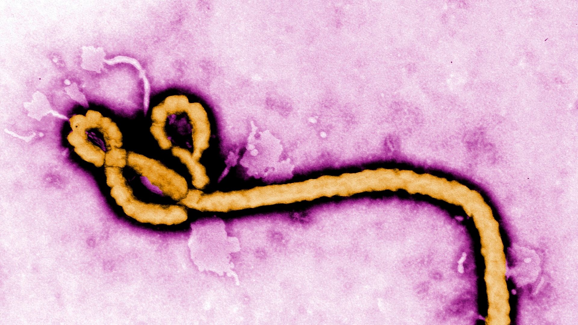 Patient tested for Ebola in British hospital