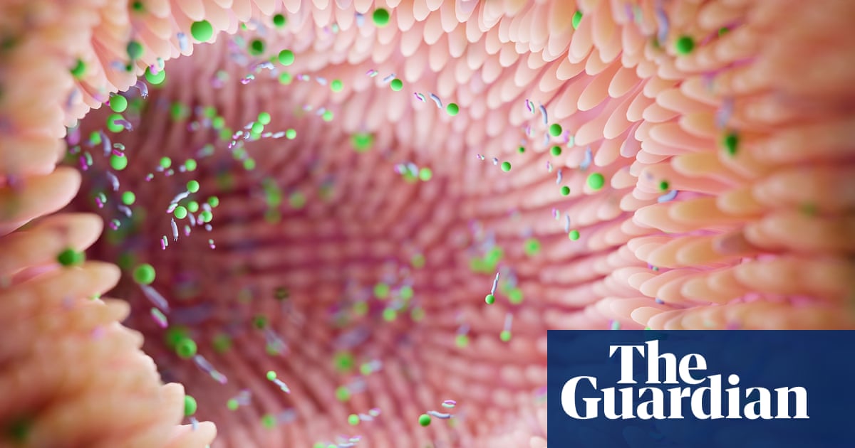 Gut microbiome can reveal risk of Parkinson’s, scientists say