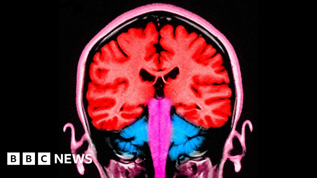 Can a pulse of electricity to the brain make us less selfish?