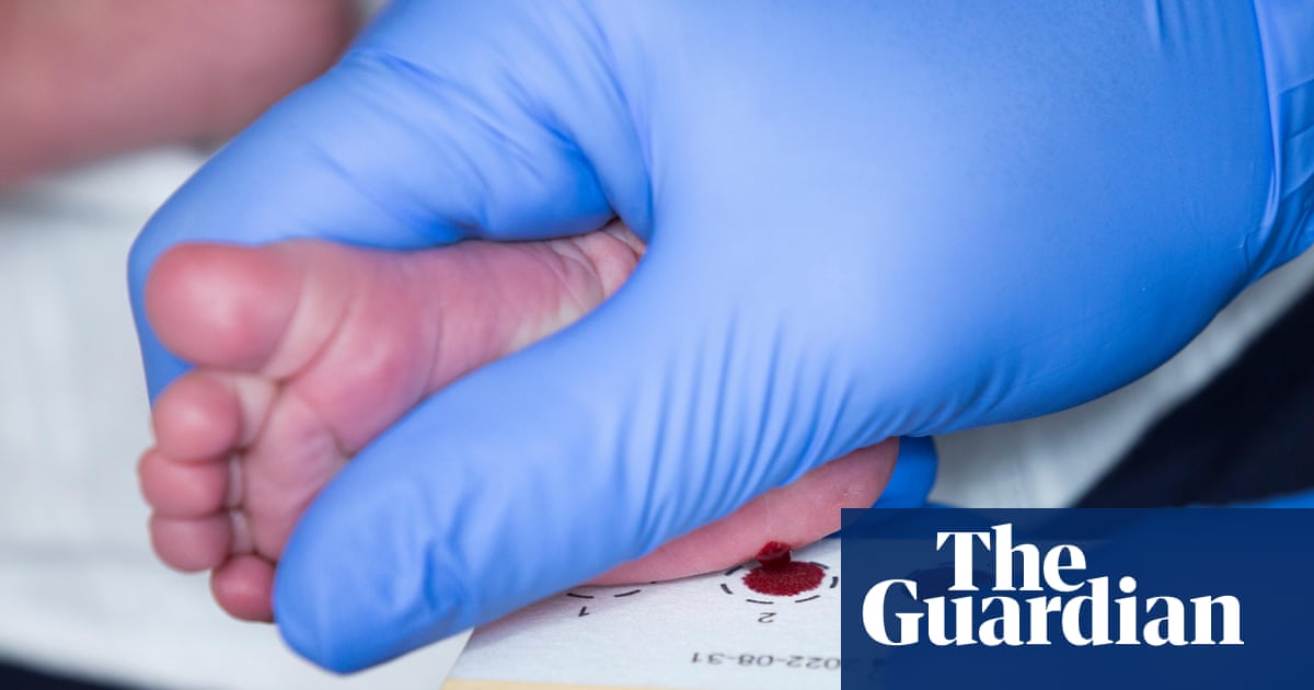 Scotland becomes first part of UK to screen newborns for spinal muscular atrophy
