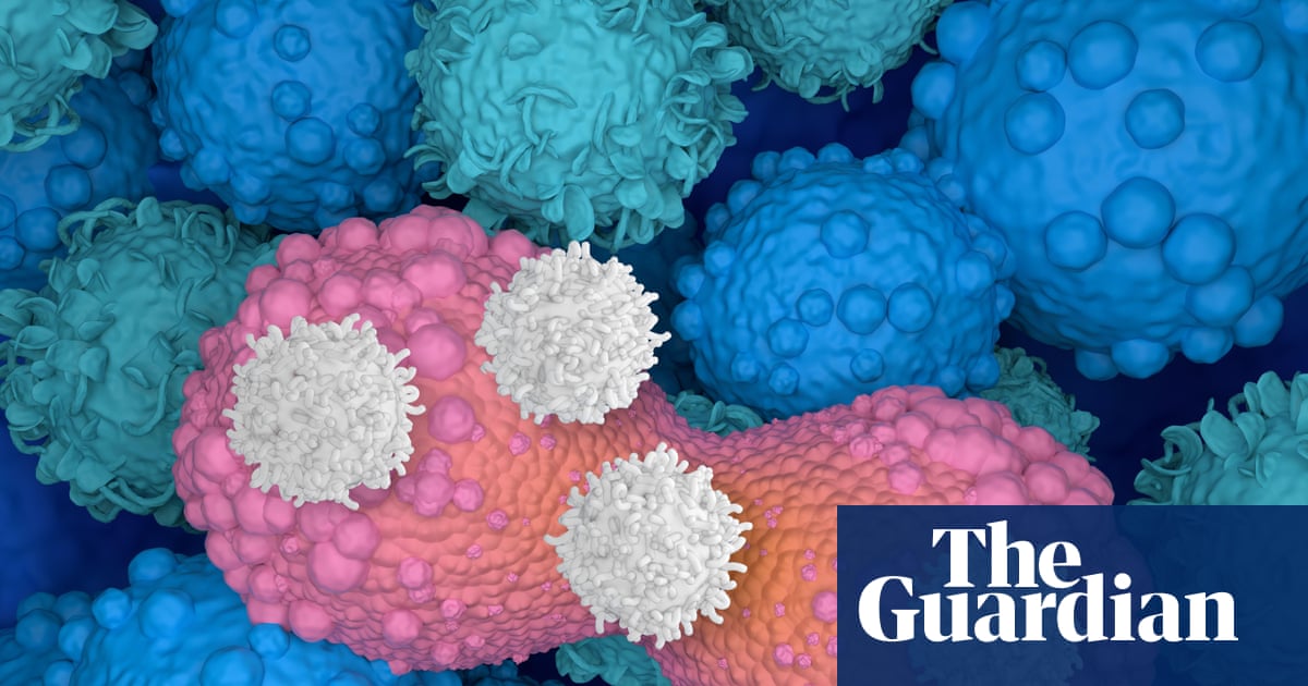 Smart drug that strips cancer cells of ‘invisibility cloak’ can shrink tumours by 30%, trial shows
