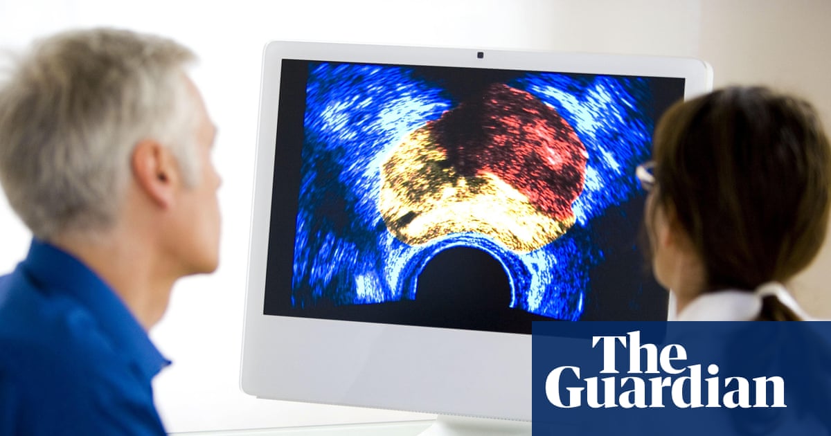Cancer death rate in Britain down by almost a third since 1980s